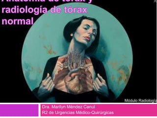 Dra. Marilyn Méndez Canul
R2 de Urgencias Médico-Quirúrgicas
Módulo Radiología
 