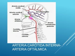 ARTERIA CARÓTIDA INTERNA-
ARTERIA OFTÁLMICA
 