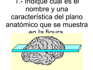 1.- Indique cual es el nombre y una característica del plano anatómico que se muestra en la figura. 