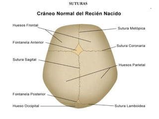 SUTURAS 