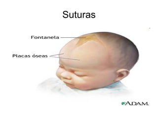 Suturas 
