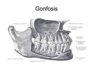 Gonfosis 