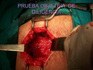 PRUEBA OBJETIVA DE
    DILIGENCIA
 