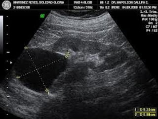Enfermedades del Sistema Urinario