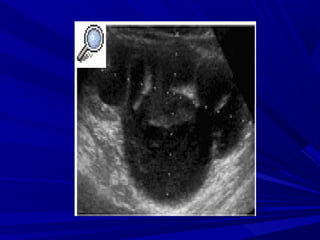 Enfermedades del Sistema Urinario