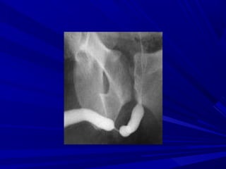 Enfermedades del Sistema Urinario