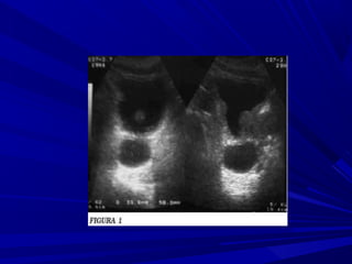 Enfermedades del Sistema Urinario