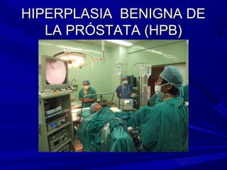 HIPERPLASIA BENIGNA DE
   LA PRÓSTATA (HPB)
 