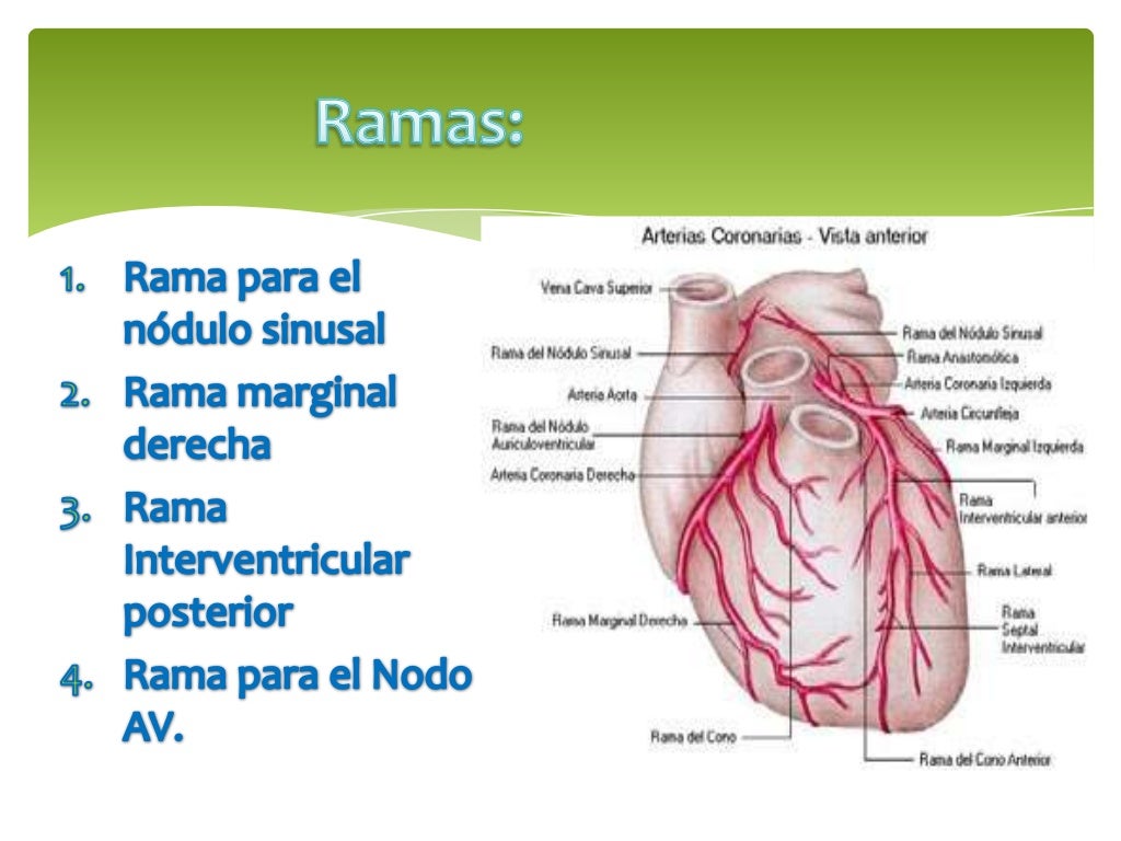 Arteria