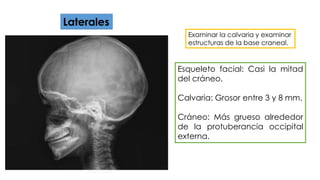 Laterales 
Examinar la calvaria y examinar 
estructuras de la base craneal. 
Esqueleto facial: Casi la mitad 
del cráneo. 
Calvaria: Grosor entre 3 y 8 mm. 
Cráneo: Más grueso alrededor 
de la protuberancia occipital 
externa. 
 