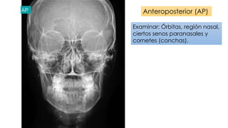 Anteroposterior (AP) 
Examinar: Órbitas, región nasal, 
ciertos senos paranasales y 
cornetes (conchas). 
 