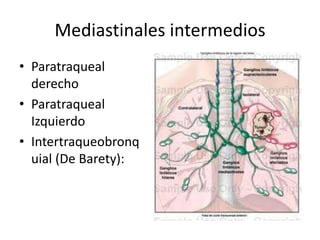 Mediastinales intermedios 
• Paratraqueal 
derecho 
• Paratraqueal 
Izquierdo 
• Intertraqueobronq 
uial (De Barety): 
 