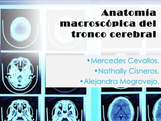 Anatomía
macroscópica del
 tronco cerebral

     •Mercedes Cevallos.
       •Nathally Cisneros.
   •Alejandra Mogrovejo.
 