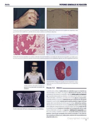 Anatomía Patólogica - Netter.pdf