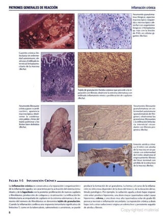 Anatomía Patólogica - Netter.pdf