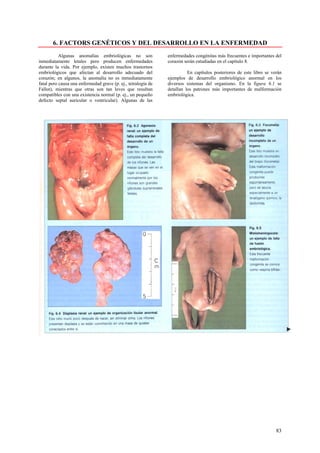 6. FACTORS GENÉTICOS Y DEL DESARROLLO EN LA ENFERMEDAD
           Algunas anomalías embriológicas no son              enfermedades congénitas más frecuentes e importantes del
inmediatamente letales pero producen enfermedades              corazón serán estudiadas en el capítulo 8.
durante la vida. Por ejemplo, existen muchos trastornos
embriológicos que afectan al desarrollo adecuado del                     En capítulos posteriores de este libro se verán
corazón; en algunos, la anomalía no es inmediatamente          ejemplos de desarrollo embriológico anormal en los
fatal pero causa una enfermedad grave (p. ej., tetralogía de   diversos sistemas del organismo. En la figura 6.1 se
Fallot), mientras que otras son tan leves que resultan         detallan los patrones más importantes de malformación
compatibles con una existencia normal (p. ej., un pequeño      embriológica.
defecto septal auricular o ventricular). Algunas de las




                                                                                                                     83
 