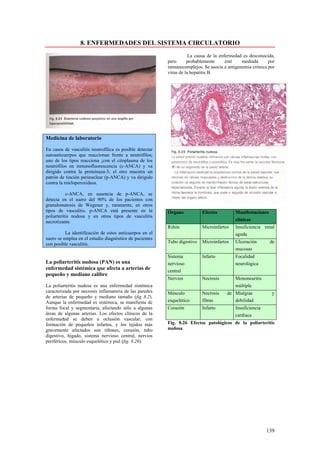 8. ENFERMEDADES DEL SISTEMA CIRCULATORIO
                                                                     La causa de la enfermedad es desconocida,
                                                          pero      probablemente      esté   mediada      por
                                                          inmunocomplejos. Se asocia a antigenemia crónica por
                                                          virus de la hepatitis B.




Medicina de laboratorio

En casos de vasculitis neutrofílica es posible detectar
autoanticuerpos que reaccionan frente a neutrófilos;
uno de los tipos reacciona ¡con el citoplasma de los
neutrófilos en inmunofluorescencia (c-ANCA) y va
dirigido contra la proteinaza-3; el otro muestra un
patrón de tinción perinuclear (p-ANCA) y va dirigido
contra la mieloperoxidasa.

           c-ANCA, en ausencia de p-ANCA, se
detecta en el suero del 90% de los pacientes con
granulomatosis de Wegener y, raramente, en otros
tipos de vasculitis. p-ANCA está presente en la           Órgano           Efectos         Manifestaciones
poliarteritis nodosa y en otros tipos de vasculitis
necrotizante.                                                                              clínicas
                                                          Riñón            Microinfartos   Insuficiencia renal
          La identificación de estos anticuerpos en el                                     aguda
suero se emplea en el estudio diagnóstico de pacientes
con posible vasculitis.                                   Tubo digestivo   Microinfartos   Ulceración        de
                                                                                           mucosas
                                                          Sistema          Infarto         Focalidad
La poliarteritis nudosa (PAN) es una                      nervioso                         neurológica
enfermedad sistémica que afecta a arterias de             central
pequeño y mediano calibre
                                                          Nervios          Necrosis        Mononeuritis
La poliarteritis nudosa es una enfermedad sistémica                                        múltiple
caracterizada por necrosis inflamatoria de las paredes    Músculo          Necrosis    de Mialgias           y
de arterias de pequeño y mediano tamaño (fig 8.2).
Aunque la enfermedad es sistémica, se manifiesta dc       esquelético      fibras         debilidad
forma focal y segmentaria, afectando sólo a algunas       Corazón          Infarto         Insuficiencia
áreas de algunas arterias. Los efectos clínicos de la                                      cardiaca
enfermedad se deben a oclusión vascular, con
formación de pequeños infartos, y los tejidos más         Fig. 8.26 Efectos patológicos de la poliarteritis
gravemente afectados son riñones, corazón, tubo           nudosa
digestivo, hígado, sistema nervioso central, nervios
periféricos, músculo esquelético y piel (fig. 8.26).




                                                                                                           139
 