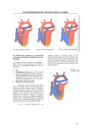 8. ENFERMEDADES DEL SISTEMA CIRCULATORIO




Los defectos que producen un cortocircuito               complejo trastorno se pretende cerrar el CIV,
permanente de derecha a izquierda son menos              recanalizar el flujo hacia la aorta sólo a partir del ven-
frecuentes                                               trículo izquierdo y aliviar la estenosis pulmonar. Esta
                                                         técnica ha aumentado mucho la supervivencia. Sus
La anomalía congénita cardiaca más importante, y         complicaciones son la endocarditis bacteriana (véase
causa frecuente de cortocircuito de derecha a            pág. 154) y los consiguientes infartos o abscesos cere-
izquierda, es la tetralogía de Fallot (fig. 8.53), que   brales secundarios.
consiste en:

•   CIV.
•   Cabalgamiento aórtico sobre la CIV, de modo
    que la aorta recibe sangre de ambos ventrículos.
•   Estenosis pulmonar, generalmente secundaria a
    engrosamiento del músculo subvalvular en el
    infundíbulo pulmonar, pero a veces asociada a
    estenosis por fusión de las valvas.
•   Hipertrofia ventricular derecha.

          Dado que la aorta anormal recibe sangre
tanto del ventrículo derecho como del izquierdo, la
circulación sistémica contiene sangre no oxigenada y
el paciente presenta cianosis clínica. La estenosis
pulmonar origina una perfusión inadecuada de los
pulmones. Los individuos afectos desarrollan un
cortocircuito de derecha a izquierda y presentan
cianosis. Con el crecimiento, la estenosis pulmonar se
mantiene fija y acaba produciendo una importante
obstrucción del vaciamiento ventricular derecho. La
mayoría de los casos se corrigen quirúrgicamente.

         Con la corrección quirúrgica de este




                                                                                                              156
 