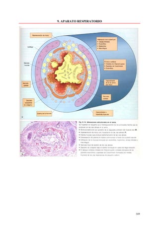 9. APARATO RESPIRATORIO




                          169
 