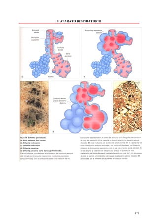 9. APARATO RESPIRATORIO




                          171
 