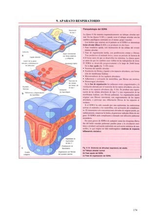 9. APARATO RESPIRATORIO




                          174
 