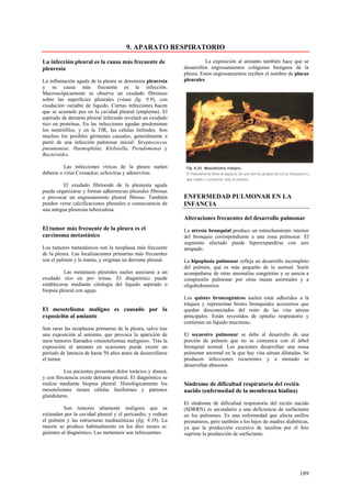 9. APARATO RESPIRATORIO

La infección pleural es la causa más frecuente de                       La exposición al amianto también hace que se
pleuresía                                                     desarrollen engrosamientos colágenos benignos de la
                                                              pleura. Estos engrosamientos reciben el nombre de placas
La inflamación aguda de la pleura se denomina pleuresía       pleurales.
y su causa más frecuente es la infección.
Macroscópicamente se observa un exudado fibrinoso
sobre las superficies pleurales (véase fig. 9.9), con
exudación variable de liquido. Ciertas infecciones hacen
que se acumule pus en la cavidad pleural (empiema). El
aspirado de derrame pleural infectado revelará un exudado
rico en proteínas. En las infecciones agudas predominan
los neutrófilos, y en la TIR, las células linfoides. Son
muchos los posibles gérmenes causales, generalmente a
partir de una infección pulmonar inicial: Streptococcus
pneumoniae, Haemophilus, Klebsiella, Pseudomonas y
Bacteroides.

          Las infecciones víricas de la pleura suelen
deberse a virus Coxsackie, echovirus y adenovirus.

          El exudado fibrinoide de la pleuresía aguda
puede organizarse y formar adherencias pleurales fibrosas
o provocar un engrosamiento pleural fibroso. También          ENFERMEDAD PULMONAR EN LA
pueden verse calcificaciones pleurales a consecuencia de      INFANCIA
una antigua pleuresía tuberculosa.
                                                              Alteraciones frecuentes del desarrollo pulmonar
El tumor más frecuente de la pleura es el                     La atresia bronquial produce un estrechamiento interior
carcinoma metastásico                                         del bronquio correspondiente a una zona pulmonar. El
                                                              segmento afectado puede hiperexpandirse con aire
Los tumores metastásicos son la neoplasia más frecuente       atrapado.
de la pleura. Las localizaciones primarias más frecuentes
son el pulmón y la mama, y originan un derrame pleural.       La hipoplasia pulmonar refleja un desarrollo incompleto
                                                              del pulmón, que es más pequeño de lo normal. Suele
          Las metástasis pleurales suelen asociarse a un      acompañarse de otras anomalías congénitas y se asocia a
exudado rico en pro teínas. El diagnóstico puede              compresión pulmonar por otras masas anormales y a
establecerse mediante citología del líquido aspirado o        oligohidramnios.
biopsia pleural con aguja.
                                                              Los quistes broncogénicos suelen estar adheridos a la
                                                              tráquea y representan brotes bronquiales accesorios que
El mesotelioma maligno es causado por la                      quedan desconectados del resto de las vías aéreas
exposici6n al amianto                                         principales. Están revestidos de epitelio respiratorio y
                                                              contienen un líquido mucinoso.
Son raras las neoplasias primarias de la pleura, salvo tras
una exposición al amianto, que provoca la aparición de        El secuestro pulmonar se debe al desarrollo de una
unos tumores llamados «mesoteliomas malignos». Tras la        porción de pulmón que no se comunica con el árbol
exposición al amianto en ocasiones puede existir un           bronquial normal. Los pacientes desarrollan una masa
período de latencia de hasta 50 años antes de desarrollarse   pulmonar anormal en la que hay vías aéreas dilatadas. Se
el tumor.                                                     producen infecciones recurrentes y a menudo se
                                                              desarrollan abscesos.
          Los pacientes presentan dolor torácico y disnea,
y con frecuencia existe derrame pleural. El diagnóstico se
realiza mediante biopsia pleural. Histológicamente los        Síndrome de dificultad respiratoria del recién
mesoteliomas tienen células fusiformes y patrones             nacido (enfermedad de la membrana hialina)
glandulares.
                                                              El síndrome de dificultad respiratoria del recién nacido
          Son tumores altamente malignos que se               (SDRRN) es secundario a una deficiencia de surfactante
extienden por la cavidad pleural y el pericardio, y rodean    en los pulmones. Es una enfermedad que afecta anillos
el pulmón y las estructuras mediastínicas (fig. 9.38). La     prematuros, pero también a los hijos de madres diabéticas,
muerte se produce habitualmente en los diez meses si-         ya que la producción excesiva de insulina por el feto
guientes al diagnóstico. Las metástasis son infrecuentes.     suprime la producción de surfactante.




                                                                                                                   189
 