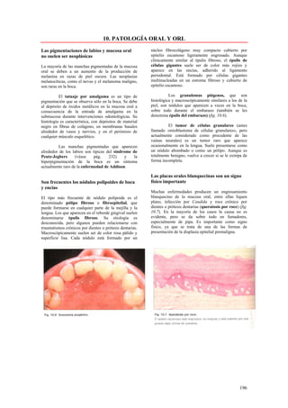 10. PATOLOGÍA ORAL Y ORL

Las pigmentaciones de labios y mucosa oral                núcleo fibrocolágeno muy compacto cubierto por
no suelen ser neoplásicas                                 epitelio escamoso ligeramente engrosado. Aunque
                                                          clínicamente similar al épulis fibroso, el épulis de
La mayoría de las manchas pigmentadas de la mucosa        células gigantes suele ser de color más rojizo y
oral se deben a un aumento de la producción de            aparece en las encías, adherido al ligamento
melanina en razas de piel oscura. Las neoplasias          periodontal. Está formado por células gigantes
melanocíticas, como el nevus y el melanoma maligno,       multinucleadas en un estroma fibroso y cubierto de
son raras en la boca.                                     epitelio escamoso.

          El tatuaje por amalgama es un tipo de                     Los granulomas piógenos, que son
pigmentación que se observa sólo en la boca. Se debe      histológica y macroscópicamente similares a los de la
al depósito de óxidos metálicos en la mucosa oral a       piel, son nódulos que aparecen a veces en la boca,
consecuencia de la entrada de amalgama en la              sobre todo durante el embarazo (también se les
submucosa durante intervenciones odontológicas. Su        denomina épulis del embarazo) (fig. 10.6).
histología es característica, con depósitos de material
negro en fibras de colágeno, en membranas basales                  El tumor de células granulares (antes
alrededor de vasos y nervios, y en el perimisio de        llamado «mioblastoma de células granulares», pero
cualquier músculo esquelético.                            actualmente considerado como procedente de las
                                                          vainas neurales) es un tumor raro que aparece
          Las manchas pigmentadas que aparecen            ocasionalmente en la lengua. Suele presentarse como
alrededor de los labios son típicas del síndrome de       un nódulo abombado o como un pólipo. Aunque es
Peutz-Jegbers      (véase    pág.    232)     y   la      totalmente benigno, vuelve a crecer si se le extirpa de
hiperpigmentación de la boca es un síntoma                forma incompleta.
actualmente raro de la enfermedad de Addison.

                                                          Las placas orales blanquecinas son un signo
Son frecuentes los nódulos polipoides de boca             físico importante
y encías
                                                          Muchas enfermedades producen un engrosamiento
El tipo más frecuente de nódulo polipoide es el           blanquecino de la mucosa oral, entre ellas liquen
denominado pólipo fibroso o fibroepitelial, que           plano, infección por Candida y roce crónico por
puede formarse en cualquier parte de la mejilla y la      dientes o prótesis dentarias (queratosis por roce) (fig.
lengua. Los que aparecen en el reborde gingival suelen    10.7). En la mayoría de los casos la causa no es
denominarse épulis fibroso. Su etiología es               evidente, pero se da sobre todo en fumadores,
desconocida, pero algunos pueden relacionarse con         especialmente de pipa. Es importante como signo
traumatismos crónicos por dientes o prótesis dentarias.   físico, ya que se trata de una de las formas de
Macroscópicamente suelen ser de color rosa pálido y       presentación de la displasia epitelial premaligna.
superficie lisa. Cada nódulo está formado por un




                                                                                                             196
 