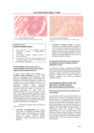 10. PATOLOGÍA ORAL Y ORL




PUNTOS CLAVE:                                               •    Carcinoma de células acinosas, que aparece
Tumores de glándulas salivales                                   sobre todo en la parótida en adultos y ancianos y
                                                                 es más frecuente en mujeres que en hombres. A
•    Más frecuentes en las glándulas salivales                   veces se denomina «tumor de células acinosas»
     principales: parótida > submandibular>                      porque la mayoría de ellas se comportan de forma
     sublingual.                                                 benigna, como el adenoma pleomorfo, y sólo en
•    Generalmente benignos. adenoma salival >                    ocasiones presentan infiltración local extensa o
     tumor de Warthin.                                           metástasis en ganglios linfáticos.
•    Los adenomas salivales pueden localizarse en
     cualquier glándula; el tumor de Warthin afecta
     casi siempre a la parótida.                            La formación de cálculos en los conductos de
                                                            las glándulas salivales principales produce
                                                            sialadenitis crónica
En las glándulas salivales son raros los
tumores malignos, que afectan sobre todo al                 La formación de cálculos o secreciones solidificadas
tejido salival secundario intraoral                         en los conductos salivales principales obstruye el flujo
                                                            de la secreción salival. La presión retrógrada dilata los
El tumor salival maligno más frecuente es el                conductos y produce atrofia de los acinos salivales,
carcinoma quístico adenoide (fig. 10.12). Puede             asociada a aumento de la fibrosis intersticial e
surgir en las glándulas salivales principales, como         infiltrado linfocitario. Esta lesión se denomina
parótida y submandibular, pero es relativamente más         sialadenitis crónica.
frecuente en el tejido salival intraoral, por ejemplo, en
el paladar. Es un tumor localmente invasivo y de
crecimiento lento, que con frecuencia se úlcera en su       TRASTORNOS FRECUENTES DE
localización      intraoral.     Aunque       metastatiza   DIENTES Y ESTRUCTURAS
tardíamente, su pronóstico es malo por su tendencia a       RELACIONADAS CON ELLOS
la invasión local muy extensa, y a crecer por los
espacios perineurales. El tumor suele ser
                                                            El trastorno más frecuente de los dientes es la
considerablemente mayor de lo que parece a simple
vista y la extirpación quirúrgica primaria no logra         caries dental
habitualmente erradicarlo por completo, por lo que las
recidivas son muy frecuentes. Esto, junto a su escasa       La caries dental se debe a una lesión del esmalte y la
radiosensibilidad, hacen que el tratamiento sea difícil.    dentina por el ácido que se forma dentro de la placa
La segunda operación tras una recidiva suele requerir       bacteriana (fig. 10.13). El ácido generado por bacterias
cirugía orofacial radical con desfiguración.                en la boca suele ser neutralizado por las secreciones
                                                            alcalinas del tejido salival. Sin embargo, cuando el
           Dos tumores malignos menos frecuentes del        ácido es producido por las bacterias de la placa, la
tejido salival son:                                         densidad física de ésta impide que la saliva llegue a la
                                                            superficie del esmalte dental. El ácido disuelve la
                                                            hidroxiapatita cálcica del esmalte y penetra
•    Carcinoma mucoepidermoide, que aparece
                                                            progresivamente en éste, descalcificándolo. Esto
     sobre todo en la parótida en ancianos, aunque
                                                            produce una cavidad visible en el diente. Al formarse
     también aparece ocasionalmente en el paladar.
                                                            la cavidad, las bacterias pueden penetrar en el diente
     Estas lesiones son de malignidad variable:
                                                            hasta la dentina y penetrar en los profundos túbulos
     algunas se comportan como el adenoma
                                                            dentinales (fig. 10.14), que se llenan de bacterias y
     pleomorfo y otras son más agresivas desde el
                                                            restos tisulares.
     principio.



                                                                                                                199
 