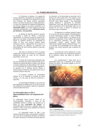 11. TUBOS DIGESTIVO
           Si el páncreas no produce o no segrega las        los enfermos y se ha demostrado su asociación con la
enzimas hidrolíticas responsables de la degradación de       presencia de ciertos grupos HLA. Por ejemplo, existe
los alimentos, los nutrientes no se absorben. Las causas     una fuerte asociación con la presencia del antígeno
más frecuentes son fibrosis quística, pancreatitis           HLA-B8, factor ligado también a una enfermedad
crónica, carcinoma del páncreas y cirugía pancreática.       cutánea ampollosa y pruriginosa, la dermatitis
La causa más importante de malabsorción dependiente          herpetiforme (véase pág. 460), que puede aparecer de
del intestino delgado en los países occidentales es la       forma concomitante con la enfermedad celiaca. En la
enfermedad celiaca; en el tercer mundo la causa más          mayoría de los casos se detecta la presencia de
importante probablemente sea la infestación masiva           anticuerpos séricos antigliadina.
por helmintos y otros parásitos.
                                                                        El diagnóstico se establece mediante biopsia
          La pérdida de superficie absortiva intestinal      de la mucosa del intestino delgado. Histológicamente,
es frecuente y puede ser debida a numerosas                  la lesión inmunológica produce un denso infiltrado
enfermedades. La resección extensa de intestino del-         linfocitario en la lámina propia y un aumento de los
gado (p. ej., por infarto o enfermedad de Crohn) reduce      linfocitos intraepiteliales. Existe también una pérdida
mucho la superficie absortiva. La enfermedad de              de la arquitectura vellositaria, que varia desde
Crohn, en casos muy intensos, produce edema                  acortamiento      (atrofia    vellosa   parcial)    hasta
submucoso extenso y aplanamiento de la mucosa, lo            aplanamiento completo (atrofia vellosa total) (fig. 11.7)
que disminuye la superficie de absorción. Las                y un aumento de la profundidad de las criptas, que
enfermedades del íleon terminal impiden la absorción         producen más células epiteliales para compensar las
de vitamina B12.                                             pérdidas.

          Sise altera la secreción de bilis, no pueden                  La eliminación total de gliadina de la dieta
solubilizarse las grasas en el intestino, y se produce una   (dieta sin gluten) permite una recuperación progresiva
malabsorción grasa, así como de las vitaminas                de la estructura vellosa, que puede ser parcial o
liposolubles, A, D, E y K.                                   completa.

           La lesión de los enterocitos intestinales hace             Las complicaciones a largo plazo de la
que sean sustituidos por células indiferenciadas que no      enfermedad celiaca son el desarrollo de un linfoma
expresan las enzimas del borde en cepillo, como lactasa      primario de células T del intestino delgado y, rara vez,
o sacarasa (deficiencia de disacaridasas). Por ese mo-       de un adenocarcinoma.
tivo, los disacáridos de la dieta no pueden degradarse y
su presencia en el intestino provoca diarrea y
sobrecrecimiento bacteriano. Esto puede ocurrir tras un
episodio de diarrea infecciosa.

          La ausencia congénita de disacaridasas
también se da en lactantes, en ausencia de lesión
mucosa, y es una causa de falta de crecimiento y
desarrollo.

           La enfermedad de Whipple es una causa rara
pero importante de malabsorción, en la cual la mucosa
está infiltrada por macrófagos repletos de organismos
actinomicetales infecciosos.


La enfermedad celiaca se debe a
hipersensibilidad frente a un componente del
gluten

La enfermedad celiaca provoca atrofia de las
microvellosidades intestinales a causa de una
sensibilidad anormal al gluten, una proteína de la
harina de trigo (enteropatía por gluten). La
enfermedad puede presentarse a cualquier edad, y en
lactantes y niños es una causa importante de falta de
crecimiento y desarrollo.

          La enfermedad celiaca se debe a una
respuesta inmunitaria frente a una proteína, la gliadina,
que es uno de los componentes del gluten. Se presenta
con mayor frecuencia en familiares de primer grado de




                                                                                                                 227
 