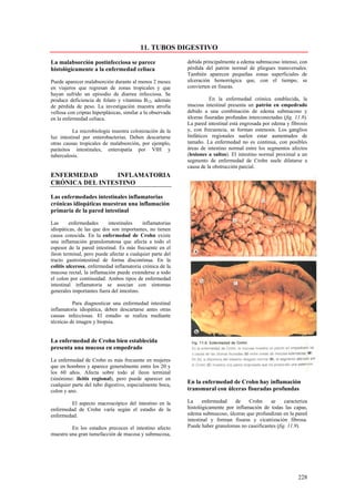 11. TUBOS DIGESTIVO

La malabsorción postinfecciosa se parece                    debida principalmente a edema submucoso intenso, con
histológicamente a la enfermedad celiaca                    pérdida del patrón normal de pliegues transversales.
                                                            También aparecen pequeñas zonas superficiales de
Puede aparecer malabsorción durante al menos 2 meses        ulceración hemorrágica que, con el tiempo, se
en viajeros que regresan de zonas tropicales y que          convierten en fisuras.
hayan sufrido un episodio de diarrea infecciosa. Se
produce deficiencia de folato y vitamina B12, además                   En la enfermedad crónica establecida, la
de pérdida de peso. La investigación muestra atrofia        mucosa intestinal presenta un patrón en empedrado
vellosa con criptas hiperplásicas, similar a la observada   debido a una combinación de edema submucoso y
en la enfermedad celiaca.                                   úlceras fisuradas profundas interconectadas (fig. 11.8).
                                                            La pared intestinal está engrosada por edema y fibrosis
          La microbiología muestra colonización de la       y, con frecuencia, se forman estenosis. Los ganglios
luz intestinal por enterobacterias. Deben descartarse       linfáticos regionales suelen estar aumentados de
otras causas tropicales de malabsorción, por ejemplo,       tamaño. La enfermedad no es continua, con posibles
parásitos intestinales, enteropatía por VIH y               áreas de intestino normal entre los segmentos afectos
tuberculosis.                                               (lesiones a saltos). El intestino normal proximal a un
                                                            segmento de enfermedad de Crohn suele dilatarse a
                                                            causa de la obstrucción parcial.
ENFERMEDAD       INFLAMATORIA
CRÓNICA DEL INTESTINO

Las enfermedades intestinales inflamatorias
crónicas idiopáticas muestran una inflamación
primaria de la pared intestinal

Las      enfermedades     intestinales     inflamatorias
idiopáticas, de las que dos son importantes, no tienen
causa conocida. En la enfermedad de Crohn existe
una inflamación granulomatosa que afecta a todo el
espesor de la pared intestinal. Es más frecuente en el
íleon terminal, pero puede afectar a cualquier parte del
tracto gastrointestinal de forma discontinua. En la
colitis ulcerosa, enfermedad inflamatoria crónica de la
mucosa rectal, la inflamación puede extenderse a todo
el colon por continuidad. Ambos tipos de enfermedad
intestinal inflamatoria se asocian con síntomas
generales importantes fuera del intestino.

          Para diagnosticar una enfermedad intestinal
inflamatoria idiopática, deben descartarse antes otras
causas infecciosas. El estudio se realiza mediante
técnicas de imagen y biopsia.


La enfermedad de Crohn bien establecida
presenta una mucosa en empedrado

La enfermedad de Crohn es más frecuente en mujeres
que en hombres y aparece generalmente entre los 20 y
los 60 años. Afecta sobre todo al íleon terminal
(sinónimo: ileitis regional), pero puede aparecer en
cualquier parte del tubo digestivo, especialmente boca,
                                                            En la enfermedad de Crohn hay inflamación
colon y ano.                                                transmural con úlceras fisuradas profundas

        El aspecto macroscópico del intestino en la         La     enfermedad    de    Crohn     se     caracteriza
enfermedad de Crohn varía según el estadio de la            histológicamente por inflamación de todas las capas,
enfermedad.                                                 edema submucoso, úlceras que profundizan en la pared
                                                            intestinal y forman fisuras y cicatrización fibrosa.
         En los estadios precoces el intestino afecto       Puede haber granulomas no caseificantes (fig. 11.9).
muestra una gran tumefacción de mucosa y submucosa,




                                                                                                               228
 