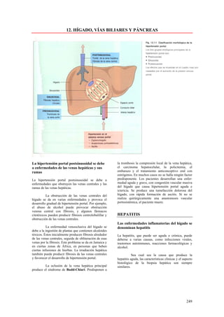 12. HÍGADO, VÍAS BILIARES Y PÁNCREAS




La hipertensión portal postsinusoidal se debe             la trombosis la compresión local de la vena hepática,
a enfermedades de las venas hepáticas y sus               el carcinoma hepatocelular, la policitemia, el
ramas                                                     embarazo y el tratamiento anticonceptivo oral con
                                                          estrógenos. En muchos casos no se halla ningún factor
La hipertensión portal postsinusoidal se debe a           predisponente. Los pacientes desarrollan una enfer-
enfermedades que obstruyen las venas centrales y las      medad aguda y grave, con congestión vascular masiva
ramas de las venas hepáticas.                             del hígado que causa hipertensión portal aguda e
                                                          ictericia. Se produce una tumefacción dolorosa del
          La obstrucción de las venas centrales del       hígado, con rápida formación de ascitis. Sí no se
hígado se da en varias enfermedades y provoca el          realiza quirúrgicamente una anastomosis vascular
desarrollo gradual de hipertensión portal. Por ejemplo,   portosistémica, el paciente muere.
el abuso de alcohol puede provocar obstrucción
venosa central con fibrosis, y algunos fármacos
citotóxicos pueden producir fibrosis centrolobulillar y   HEPATITIS
obstrucción de las venas centrales.
                                                          Las enfermedades inflamatorias del hígado se
           La enfermedad venooclusiva del hígado se       denominan hepatitis
debe a la ingestión de plantas que contienen alcaloides
tóxicos. Éstos inicialmente producen fibrosis alrededor   La hepatitis, que puede ser aguda o crónica, puede
de las venas centrales, seguida de obliteración de esas   deberse a varias causas, como infecciones virales,
venas por la fibrosis. Este problema se da en Jamaica y   trastornos autoinmunes, reacciones farmacológicas y
en ciertas zonas de África, en personas que beben         alcohol.
ciertas infusiones de hierbas. La irradiación hepática
también puede producir fibrosis de las venas centrales               Sea cual sea la causa que produce la
y favorecer el desarrollo de hipertensión portal.         hepatitis aguda, las características clínicas y el aspecto
                                                          histológico de la biopsia hepática son siempre
         La oclusión de la vena hepática principal        similares.
produce el síndrome de Budd-Chiari. Predisponen a




                                                                                                               249
 