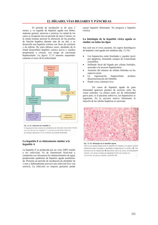 12. HÍGADO, VÍAS BILIARES Y PÁNCREAS
          El período de incubación es de unos 2           causar hepatitis fulminante. No progresa a hepatitis
meses, y va seguido de hepatitis aguda con fiebre,        crónica.
malestar general, anorexia e ictericia. La mitad de los
casos se recuperan tras un período de unos 2 meses; en
la mitad restante persiste la alteración de las pruebas   La histología de la hepatitis vírica aguda es
de función hepática durante más de un año, y se           similar en todos los tipos
desarrolla una hepatitis crónica con fases de remisión
y de rebrote. De estos últimos casos, alrededor de la     Sea cual sea el virus causante, los signos histológicos
mitad desarrollará hepatitis crónica activa y muchos      de hepatitis viral aguda son similares (fig. 12.16):
progresarán a cirrosis, con riesgo de carcinoma
hepatocelular. La figura 12.15 muestra esquemáti-         •    Los hepatocitos están hinchados y pueden morir
camente el curso de la enfermedad.                             por apoptosis, formando cuerpos de Councilman
                                                               eosinófilos.
                                                          •    Infiltrado focal del hígado por células linfoides,
                                                               asociado a la necrosis hepatocitaria.
                                                          •    Aumento del número de células linfoides en los
                                                               espacios porta.
                                                          •    La      regeneración     hepatocelular    produce
                                                               desestructuración del lobulillo.
                                                          •    Puede verse colestasis leve.

                                                                    En casos de hepatitis aguda de gran
                                                          intensidad aparecen puentes de necrosis entre las
                                                          venas centrales. La clínica suele ser de enfermedad
                                                          grave pero, si el paciente sobrevive, los hepatocitos se
                                                          regeneran. En la necrosis masiva fulminante la
                                                          mayoría de las células hepáticas se necrosan.




La hepatitis E es clínicamente similar a la
hepatitis A

La hepatitis E es producida por un virus ARN similar
a los calicivirus. Es de transmisión fecal-oral y
contamina con frecuencia los abastecimientos de agua,
produciendo epidemias de hepatitis aguda autolimita-
da. Presenta un período de incubación de alrededor de
1 mes y habitualmente provoca una infección leve con
ictericia. La infección en mujeres gestantes puede




                                                                                                             252
 