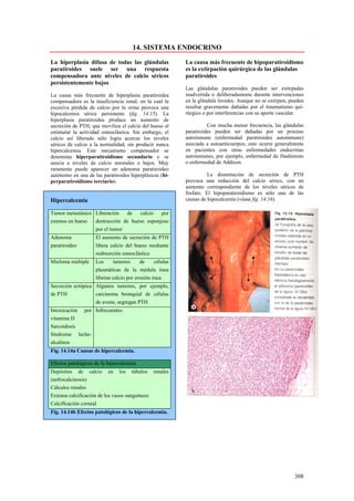 14. SISTEMA ENDOCRINO

La hiperplasia difusa de todas las glándulas              La causa más frecuente de hipoparatiroidismo
paratiroides suele ser una respuesta                      es la extirpación quirúrgica de las glándulas
compensadora ante niveles de calcio séricos               paratiroides
persistentemente bajos
                                                          Las glándulas paratiroides pueden ser extirpadas
La causa más frecuente de hiperplasia paratiroidea        inadvertida o deliberadamente durante intervenciones
compensadora es la insuficiencia renal, en la cual la     en la glándula tiroides. Aunque no se extirpen, pueden
excesiva pérdida de calcio por la orina provoca una       resultar gravemente dañadas por el traumatismo qui-
hipocalcemia sérica persistente (fig. 14.15). La          rúrgico o por interferencias con su aporte vascular.
hiperplasia paratiroidea produce un aumento de
secreción de PTH, que moviliza el calcio del hueso al               Con mucha menor frecuencia, las glándulas
estimular la actividad osteoclástica. Sin embargo, el     paratiroides pueden ser dañadas por un proceso
calcio así liberado sólo logra acercar los niveles        autoinmune (enfermedad paratiroidea autoinmune)
séricos de calcio a la normalidad, sin producir nunca     asociada a autoanticuerpos; esto ocurre generalmente
hipercalcemia. Este mecanismo compensador se              en pacientes con otras enfermedades endocrinas
denomina hiperparatiroidismo secundario y se              autoinmunes, por ejemplo, enfermedad de Hashimoto
asocia a niveles de calcio normales o bajos. Muy          o enfermedad de Addison.
raramente puede aparecer un adenoma paratiroideo
autónomo en una de las paratiroides hiperplásicas (hi-              La disminución de secreción de PTH
perparatiroidismo terciario).                             provoca una reducción del calcio sérico, con un
                                                          aumento correspondiente de los niveles séricos de
                                                          fosfato. El hipoparatiroidismo es sólo una de las
Hipercalcemia                                             causas de hipocalcemia (véase fig. 14.16).

Tumor metastásico Liberación   de    calcio  por
extenso en hueso  destrucción de hueso esponjoso
                  por el tumor
Adenoma             El aumento de secreción de PTH
paratiroideo        libera calcio del hueso mediante
                    reabsorción osteoclástica
Mieloma múltiple    Los     tumores      de     células
                    plasmáticas de la médula ósea
                    liberan calcio por erosión ósea
Secreción ectópica Algunos tumores, por ejemplo,
de PTH             carcinoma bronquial de células
                   de avene, segregan PTH
Intoxicación por Infrecuentes
vitamina D
Sarcoidosis
Síndrome leche-
alcalinos
Fig. 14.14a Causas de hipercalcemia.

Efectos patológicos de fa hipercalcemia
Depósitos de calcio en los túbulos renales
(nefrocalcinosis)
Cálculos renales
Extensa calcificación de los vasos sanguíneos
Calcificación corneal
Fig. 14.14b Efectos patológicos de la hipercalcemia.




                                                                                                           308
 