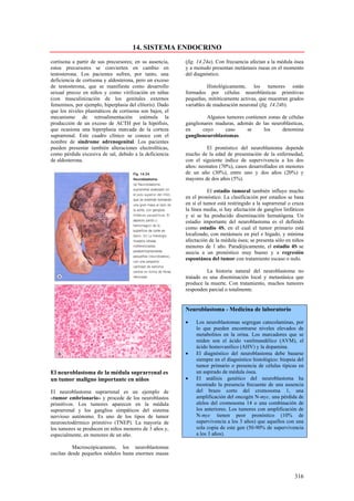 14. SISTEMA ENDOCRINO
cortisona a partir de sus precursores; en su ausencia,    (fig. 14.24a). Con frecuencia afectan a la médula ósea
estos precursores se convierten en cambio en              y a menudo presentan metástasis óseas en el momento
testosterona. Los pacientes sufren, por tanto, una        del diagnóstico.
deficiencia de cortisona y aldosterona, pero un exceso
de testosterona, que se manifiesta como desarrollo                  Histológicamente, los tumores están
sexual precoz en niños y como virilización en niñas       formados por células neuroblásticas primitivas
(con masculinización de los genitales externos            pequeñas, mitóticamente activas, que muestran grados
femeninos, por ejemplo, hiperplasia del clítoris). Dado   variables de maduración neuronal (fig. 14.24b).
que los niveles plasmáticos de cortisona son bajos, el
mecanismo de retroalimentación estimula la                         Algunos tumores contienen zonas de células
producción de un exceso de ACTH por la hipófisis,         ganglionares maduras, además de las neuroblástícas,
que ocasiona una hiperplasia marcada de la corteza        en     cuyo     caso      se     los     denomina
suprarrenal. Este cuadro clínico se conoce con el         ganglioneuroblastomas.
nombre de síndrome adrenogenital. Los pacientes
pueden presentar también alteraciones electrolíticas,              El pronóstico del neuroblastoma depende
como pérdida excesiva de sal, debido a la deficiencia     mucho de la edad de presentación de la enfermedad,
de aldosterona.                                           con el siguiente índice de supervivencia a los dos
                                                          años: neonatos (70%), casos desarrollados en menores
                                                          de un año (30%), entre uno y dos años (20%) y
                                                          mayores de dos años (5%).

                                                                     El estadio tumoral también influye mucho
                                                          en el pronóstico. La clasificación por estadios se basa
                                                          en sí el tumor está restringido a la suprarrenal o cruza
                                                          la línea media, si hay afectación de ganglios linfáticos
                                                          y si se ha producido diseminación hematógena. Un
                                                          estadio importante del neuroblastoma es el definido
                                                          como estadio 4S, en el cual el tumor primario está
                                                          localizado, con metástasis en piel e hígado, y mínima
                                                          afectación de la médula ósea; se presenta sólo en niños
                                                          menores de 1 año. Paradójicamente, el estadio 4S se
                                                          asocia a un pronóstico muy bueno y a regresión
                                                          espontánea del tumor con tratamiento escaso o nulo.

                                                                    La historia natural del neuroblastoma no
                                                          tratado es una diseminación local y metastásica que
                                                          produce la muerte. Con tratamiento, muchos tumores
                                                          responden parcial o totalmente.


                                                          Neuroblastoma - Medicina de laboratorio

                                                          •    Los neuroblastomas segregan catecolaminas, por
                                                               lo que pueden encontrarse niveles elevados de
                                                               metabolitos en la orina. Los marcadores que se
                                                               miden son el ácido vanilmandélico (AVM), el
                                                               ácido homovanílico (AHV) y la dopamina.
                                                          •    El diagnóstico del neuroblastoma debe basarse
                                                               siempre en el diagnóstico histológico: biopsia del
                                                               tumor primario o presencia de células típicas en
El neuroblastoma de la médula suprarrenal es                   un aspirado de médula ósea.
un tumor maligno importante en niños                      •    El análisis genético del neuroblastoma ha
                                                               mostrado la presencia frecuente de una ausencia
El neuroblastoma suprarrenal es un ejemplo de                  del brazo corto del cromosoma 1, una
«tumor embrionario» y procede de los neuroblastos              amplificación del oncogén N-myc, una pérdida de
primitivos. Los tumores aparecen en la médula                  alelos del cromosoma 14 o una combinación de
suprarrenal y los ganglios simpáticos del sistema              los anteriores. Los tumores con amplificación de
nervioso autónomo. Es uno de los tipos de tumor                N-myc tienen peor pronóstico (10% de
neuroectodérmico primitivo (TNEP). La mayoría de               supervivencia a los 3 años) que aquellos con una
los tumores se producen en niños menores de 3 años y,          sola copia de este gen (50-90% de supervivencia
especialmente, en menores de un año.                           a los 3 años).

          Macroscópicamente, los neuroblastomas
oscilan desde pequeños nódulos hasta enormes masas



                                                                                                             316
 
