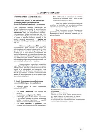 15. APARATO URINARIO

ENFERMEDADES GLOMERULARES                                       Estas células están en contacto con la superficie
                                                                externa de la membrana basal a través de una
El glomérulo es la diana de muchos procesos                     serie de prolongaciones o «pies».
patológicos, en los que producen una
                                                                      En el hilio vascular del glomérulo las células
alteración funcional transitoria o permanente
                                                           epiteliales se continúan con las células epiteliales
                                                           aplanadas que revisten la cápsula de Bowman.
Como componente altamente especializado del
sistema circulatorio, responsable de la ultrafiltración,
                                                                     En el glomérulo se observan cinco patrones
el glomérulo puede ser dañado por: vasculopatías
                                                           principales de respuesta frente a la lesión.
generalizadas, sobre todo la hipertensión (véase pág.
                                                           Combinándolos pueden describirse todos los tipos de
322), vasculitis y diabetes mellitus (véase pág. 335);
                                                           glomerulopatías.
trastornos inmunológicos, especialmente aquellos en
los cuales se depositan complejos inmunes en las
paredes capilares glomerulares, y depósito de
materiales extraños, por ejemplo, amiloide (véase
cap. 23).

          El término de glomerulonefritis se emplea
tradicionalmente para describir un grupo de
enfermedades en las cuales la lesión principal es algún
tipo de alteración estructural del glomérulo. A pesar
del sufijo -itis, la mayor parte no se caracterizan por
cambios inflamatorios. La lesión glomerular puede ser
intensa y provocar una fibrosis permanente, en cuyo
caso el túbulo asociado se atrofia. Otras veces, algunas
enfermedades producen alteraciones transitorias y, tras
su resolución, la nefrona vuelve a funcionar.

           Las enfermedades glomerulares se clasifican
según el patrón histológico de la lesión observada en
la biopsia renal, por tanto, es necesario conocer este
aspecto de la histopatología para comprender estas
enfermedades. Esta clasificación se complementa con
otras de tipo etiológico. En muchos casos no está clara
la causa de la glomerulopatía, por lo que algunos tipos
se consideran idiopáticos.


El glomérulo posee un número limitado de
respuestas histológicas frente a la lesión

El glomérulo consta        de    cuatro    componentes
principales (fig. 15.5):

•    Las células endoteliales, que revisten los
     capilares.
•    La membrana basal glomerular (MBG).
•    El mesangio, que es el «mesenterio» que sostiene
     a los capilares, formado por células mesangiales
     (células conectivas fagocíticas) y material
     extracelular asociado (matriz mesangial).
•    Las células epiteliales o «podocitos», que
     forman el revestimiento externo de los capilares.




                                                                                                               323
 
