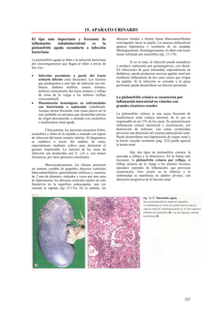 15. APARATO URINARIO

El tipo más importante y frecuente de                       abscesos tienden a formar líneas blancoamarillentas
inflamación     tubulointersticial es    la                 convergentes hacia la papila. La mucosa pielocalicial
pielonefritis aguda secundaria a infección                  aparece hiperémica o recubierta de un exudado
                                                            fibrinopurulento. Histológicamente, el riñón está local-
bacteriana
                                                            mente infiltrado por neutrófilos (fig. 15.17b).
La pielonefritis aguda se debe a la infección bacteriana
                                                                      Si no se trata, la infección puede extenderse
por microorganismos que llegan al riñón a través de
                                                            y producir septicemia por gramnegativos, con shock.
dos vías:
                                                            En infecciones de gran intensidad, especialmente en
                                                            diabéticos, puede producirse necrosis papilar renal por
•    Infección ascendente a partir del tracto
                                                            trombosis inflamatoria de los vasos rectos que irrigan
     urinario inferior (más frecuente). Los factores
                                                            las papilas. Si la infección se extiende a la grasa
     que predisponen a este tipo de infección son em-
                                                            perirrenal, puede desarrollarse un absceso perirrenal.
     barazo, diabetes mellitus, estasis urinario,
     defectos estructurales del tracto urinario y reflujo
     de orina de la vejiga a los uréteres (reflujo
     vesicoureteral).                                       La pielonefritis crónica se caracteriza por
•    Diseminación hematógena en enfermedades                inflamación intersticial en relación con
     con bacteriemia o septicemia (inhabitual).             grandes cicatrices renales
     Aunque menos frecuente, esta causa parece ser la
     más probable en ancianos que desarrollan pirexia       La pielonefritis crónica es una causa frecuente de
     de origen desconocido, a menudo con escalofríos        insuficiencia renal crónica terminal, de la que es
     e insuficiencia renal aguda.                           responsable en un 15% de los casos. Se caracteriza por
                                                            inflamación crónica intersticial y cicatrización, con
          Clínicamente, los pacientes presentan fiebre,     destrucción de nefronas. Las zonas cicatriciales
escalofríos y dolor en la espalda, a menudo con signos      provocan una distorsión del sistema pielocalicial renal.
de infección del tracto urinario inferior. El diagnóstico   Puede desarrollarse una hipertensión de origen renal y
se establece a través del análisis de orina,                la lesión vascular resultante (pág. 322) puede agravar
especialmente mediante cultivo para demostrar el            la lesión renal.
germen responsable. La mayoría de los casos de
infección son producidos por E. coli y, con menor                      Hay dos tipos de pielonefritis crónica: la
frecuencia, por otros gérmenes intestinales.                asociada a reflujo y la obstructiva. En la forma más
                                                            frecuente, la pielonefritis crónica por reflujo, el
          Macroscópicamente, los riñones presentan          reflujo urinario de la vejiga a los uréteres favorece
un número variable de pequeños abscesos corticales          episodios repetidos de inflamación, que provocan
blancoamarillentos, generalmente esféricos y menores        cicatrización. Esto ocurre en la infancia y la
de 2 mm de diámetro, rodeados a veces por una zona          enfermedad se manifiesta en adultos jóvenes, con
de hiperenemia; los abscesos corticales suelen ser más      alteración progresiva de la función renal.
llamativos en la superficie subescapular, una vez
retirada la cápsula (fig 15.17a). En la mé4ula, los




                                                                                                               337
 