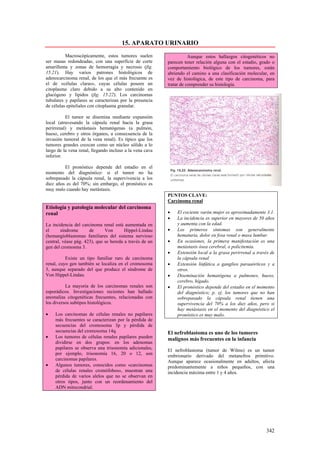 15. APARATO URINARIO
          Macroscópicamente, estos tumores suelen                    Aunque estos hallazgos citogenéticos no
ser masas redondeadas, con una superficie de corte        parecen tener relación alguna con el estadio, grado o
amarillenta y zonas de hemorragia y necrosis (fig.        comportamiento biológico de los tumores, están
15.21). Hay varios patrones histológicos de               abriendo el camino a una clasificación molecular, en
adenocarcinoma renal, de los que el más frecuente es      vez de histológica, de este tipo de carcinoma, para
el de «células claras», cuyas células poseen un           tratar de comprender su histología.
citoplasma claro debido a su alto contenido en
glucógeno y lípidos (fig. 15.22). Los carcinomas
tubulares y papilares se caracterizan por la presencia
de células epiteliales con citoplasma granular.

          El tumor se disemina mediante expansión
local (atravesando la cápsula renal hacia la grasa
perirrenal) y metástasis hematógenas (a pulmón,
hueso, cerebro y otros órganos, a consecuencia de la
invasión tumoral de la vena renal). Es típico que los
tumores grandes crezcan como un núcleo sólido a lo
largo de la vena renal, llegando incluso a la vena cava
inferior.

         El pronóstico depende del estadio en el
momento del diagnóstico: si el tumor no ha
sobrepasado la cápsula renal, la supervivencia a los
diez años es del 70%; sin embargo, el pronóstico es
muy malo cuando hay metástasis.
                                                          PUNTOS CLAVE:
                                                          Carcinoma renal
Etiología y patología molecular del carcinoma
renal                                                     •   El cociente varón:mujer es aproximadamente 3.1.
                                                          •   La incidencia es superior en mayores de 50 años
La incidencia del carcinoma renal está aumentada en           y aumenta con la edad.
el      síndrome      de      Von       Hippel-Lindau     •   Los primeros síntomas son generalmente
(hemangioblastomas familiares del sistema nervioso            hematuria, dolor en fosa renal o masa lumbar.
central, véase pág. 423), que se hereda a través de un    •   En ocasiones, la primera manifestación es una
gen del cromosma 3.                                           metástasis ósea cerebral, o policitemia.
                                                          •   Extensión local a la grasa perirrenal a través de
          Existe un tipo familiar raro de carcinoma           la cápsula renal
renal, cuyo gen también se localiza en el cromosoma       •   Extensión linfática a ganglios paraaórticos y a
3, aunque separado del que produce el síndrome de             otros.
Von Hippel-Lindau.                                        •   Diseminación hematógena a pulmones, hueso,
                                                              cerebro, hígado.
          La mayoría de los carcinomas renales son        •   El pronóstico depende del estadio en el momento
esporádicos. Investigaciones recientes han hallado            del diagnóstico; p. ej, los tumores que no han
anomalías citogenéticas frecuentes, relacionadas con          sobrepasado la cápsula renal tienen una
los diversos subtipos histológicos.                           supervivencia del 70% a los diez años, pero si
                                                              hay metástasis en el momento del diagnóstico el
•   Los carcinomas de células renales no papilares            pronóstico es muy malo.
    más frecuentes se caracterizan por la pérdida de
    secuencias del cromosoma 3p y pérdida de
    secuencias del cromosoma 14q.                         El nefroblastoma es uno de los tumores
•   Los tumores de células renales papilares pueden       malignos más frecuentes en la infancia
    dividirse en dos grupos: en los adenomas
    papilares se observa una trisonomía adicionales,      El nefroblastoma (tumor de Wilms) es un tumor
    por ejemplo, trisonomía 16, 20 o 12, son              embrionario derivado del metanefros primitivo.
    carcinomas papilares.                                 Aunque aparece ocasionalmente en adultos, afecta
•   Algunos tumores, conocidos como «carcinomas           predominantemente a niños pequeños, con una
    de células renales cromófobos», muestran una          incidencia máxima entre 1 y 4 años.
    pérdida de varios alelos que no se observan en
    otros tipos, junto con un reordenamiento del
    ADN mitocondrial.




                                                                                                          342
 