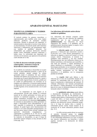 16. APARATO GENITAL MASCULINO


                                                             16
                            APARATO GENITAL MASCULINO

TESTÍCULO, EPIDÍDIMO Y TEJIDOS                                    Las infecciones del testículo suelen afectar
PARATESTICULARES                                                  también al epidídimo

El testículo produce los gametos masculinos, o                    Las infecciones del testículo (orquitis) suelen
espermatozoides, pero también actúa como órgano                   producirse a partir de una infección del epidídimo
endocrino productor de hormonas sexuales                          (epididimitis), por lo que constituyen una
masculinas. Durante el desarrollo del organismo, el               epididimoorquitis. Las infecciones de mayor
testículo puede no descender al escroto, lo que afecta a          importancia del testículo y el epidídimo son la
su funcionamiento. El testículo puede sufrir trastornos           epididimoorquitis bacteriana aguda, la orquitis viral y
infecciosos e inflamatorios, que generalmente impli-              la epididimoorquitis tuberculosa.
can también al epidídimo adyacente. Las
enfermedades que producen destrucción testicular                            La infección aguda suele ser causada por
pueden causar infertilidad, trastornos endocrinos o               gonococos y Chlamydia (por transmisión sexual) o
ambas cosas. La enfermedad más importante del                     Escherichia coli y otros bacilos gramnegativos. La
testículo son los tumores, que aparecen en las primeras           infección se adquiere a través de la uretra y el tracto
cuatro décadas de la vida.                                        urinario inferior. Clínicamente, el testículo y el
                                                                  epidídimo están tumefactos y son muy sensibles.
                                                                  Histológicamente hay una infiltración extensa de los
                                                                  túbulos seminíferos y del intersticio por neutrófilos, y
La falta de descenso testicular produce
                                                                  más tarde por linfocitos y células plasmáticas; el
criptorquidia y aumenta el riesgo de                              edema intersticial es considerable y a menudo hay
desarrollo de tumores testiculares                                hemorragias parcheadas con un tratamiento antibiótico
                                                                  eficaz las lesiones se curan y cicatrizan, pero pueden
En el embrión, los testículos se desarrollan en la parte          quedar lesiones permanentes en los túbulos
alta de la pared abdominal posterior, a partir de las             seminíferos y el epidídimo, con la consiguiente
crestas genitales, adonde emigran las células                     pérdida de fertilidad.
germinales desde el endodermo del saco vitelino.
Alrededor del séptimo mes de gestación, los testículos                      La orquitis viral suele deberse a una
descienden por la pared abdominal posterior y pasan a             infección por el virus de la parotiditis después de la
través del anillo inguinal hasta el escroto, guiados por          pubertad. La enfermedad suele ser unilateral y se
un cordón (el gubernaculum). En ocasiones no se                   asocia a tumefacción y dolorimiento del testículo. El
completa esta emigración y el testículo queda detenido            infiltrado inflamatorio está formado principalmente
en algún punto de su trayecto normal, generalmente en             por linfocitos y células plasmáticas. En una pequeña
el anillo inguinal, en las cercanías de éste o en el canal        parte de los casos, la afectación bilateral tras la puber-
inguinal.                                                         tad puede reducir la fertilidad.
           La temperatura en esos lugares es lo                              La epididimitis tuberculosa puede deberse
suficientemente elevada para impedir la evolución                 a diseminación hematógena de micobacterias al
normal de las células germinales, de forma que los                testículo durante una fase de TB pulmonar activa.
testículos se mantienen pequeños, y conservan los                 También puede deberse a diseminación de la infección
túbulos seminíferos revestidos sólo por células de                a partir del riñón y el tracto urinario inferior. Las
Sertoli; a este testículo se le denomina criptorquídico.          bacterias son secuestradas en el epidídimo, donde
En testículos no descendidos las células germinales no            producen una destrucción caseosa lentamente progre-
llegan a desarrollarse nunca adecuadamente, lo que                siva a lo largo de muchos años; a menudo la
hace imposible la producción de espermatozoides                   enfermedad persiste mucho tiempo después de la
maduros. Se puede lograr cierto funcionamiento del                resolución de la lesión tuberculosa primaria inicial
testículo si se le hace descender quirúrgicamente y en            (fig. 16.1).
una fase precoz hasta la bolsa escrotal, mediante una
operación       denominada        «orquidopexia».    La                    La sífilis terciaria puede afectar en ocasiones
criptorquidia es unilateral en el 75% de los casos                al testículo, formando gomas. La orquitis
(bilateral en el 25%). Es importante detectar y corregir          granulomatosa, enfermedad de etiología desconocida,
los testículos no descendidos, ya que el riesgo de                es una enfermedad inflamatoria en la que se produce
desarrollar tumores malignos es muy elevado en ellos              una reacción inflamatoria con histiocitos y células
(véase pág. 354).                                                 gigantes asociada a la destrucción de túbulos
                                                                  seminíferos.




                                                                                                                       350
 