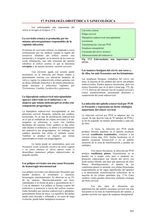 17. PATOLOGÍA OBSTÉTRICA Y GINECOLÓGICA
          Las enfermedades más importantes del
cérvix se recogen en la figura 17.5.                        Cervicitis crónica
                                                            Pólipo cervical
La cervicitis crónica es producida por los                  Hiperplasia endocervical microglandular
mismos microorganismos responsables de la                   Leiomioma
vaginitis infecciosa                                        Transformación viral por PVH
                                                            Neoplasia intraepitelial
El término de «cervicitis crónica» es empleado a veces
erróneamente por los médicos cuando la región del           Carcinoma del cérvix invasivo
ectocérvix alrededor del orificio externo está              Adenocarcinoma del endocérvix
enrojecida y es irregular; en la mayoría de los casos no    Fig. 17.5 Enfermedades más importantes del
existe inflamación, sino sólo extensión del epitelio        cérvix.
cilíndrico al orificio externo, lo que se denomina
ectropión o, de manera inexacta, «erosión cervical».
                                                            Los tumores benignos del cérvix son raros y,
          Una cervicitis aguda con erosión puede
presentarse en la infección por herpes simple y             de ellos, los más frecuentes son los leiomiomas
generalmente coexiste con afectación herpética de
vulva y vagina. La endocervicitis crónica genuina, con      Las neoplasias benignas verdaderas del cérvix son
un denso infiltrado linfocítico y de células plasmáticas,   raras; la mayoría de los nódulos del cérvix son pólipos
puede asociarse a infecciones vaginales por                 endocervicales. Pueden aparecer leiomiomas, pero son
Trichomonas, Candida, Gardnerella y gonococos.              menos frecuentes que en el útero (véase pág. 375, fig.
                                                            17.17). Derivan del músculo liso de la pared cervical y
                                                            crecen asimétricamente, presentando distorsión y
                                                            comprensión del canal endocervical.
La hiperplasia endocervical microglandular
aparece sobre todo en el embarazo y en
mujeres que toman anticonceptivos orales con                La infección del epitelio ectocervical por PVH
componente progestágeno                                     es frecuente y representa un factor etiológico
                                                            importante del cáncer cervical
La hiperplasia endocervical microglandular es una
alteración cervical frecuente, inducida por cambios
                                                            La infección cervical por PVH se adquiere por vía
hormonales. Es un tipo de proliferación endocervical
                                                            sexual. Se han descrito más de 70 subtipos de PVH y
en el que se multiplican las criptas cervicales y se de-
                                                            se les ha asignado un número determinado a cada uno
sorganiza su estructura, a veces con cambios
                                                            de ellos.
deciduales del estroma. Estos cambios se dan sobre
todo durante el embarazo y se deben a la estimulación
                                                                       A veces, la infección por PVH puede
del endocérvix por progestágenos; sin embargo, los
                                                            producir lesiones papilares en el epitelio escamoso
cambios persisten tras retirar el estímulo causal.
                                                            cervical (condilomas acuminados), similares a los
También se produce en mujeres que toman
                                                            vulvares (véase pág. 362). Suelen localizarse en el
anticonceptivos orales con progestágenos.
                                                            epitelio escamoso ectocervical o en el epitelio
                                                            escamoso de la zona de transformación, y pueden ser
          La lesión puede ser asintomática, pero con
                                                            múltiples.
frecuencia existe secreción excesiva de moco vaginal
y en casos intensos el cérvix parece como si
                                                                       Con mayor frecuencia, la infección por PVH
desarrollara numerosos pólipos endocervicales de
                                                            produce condilomas planos. Generalmente no se
pequeño tamaño.
                                                            pueden ver a simple vista, pero sí mediante ex-
                                                            ploración colposcópica tras tinción del cérvix con
                                                            ácido acético diluido, que hace que aparezcan de color
Los pólipos cervicales son una causa frecuente              blanco. Histológicamente, el epitelio de los
de hemorragia intermenstrual                                condilomas planos es anormal, con células binucleadas
                                                            (especialmente en las capas superficiales del epitelio)
Los pólipos cervicales son alteraciones frecuentes que      y la denominada «transformación coilocítica» de la
pueden producir, al erosionarse y ulcerarse,                mayoría de las células epiteliales (fig. 17.6). Estos
hemorragias intermenstruales. Se observan en un 5%          cambios virales pueden observarse mediante citología
de las mujeres. Macroscópicamente son lisos,                del frotis cervical.
redondeados o en forma de pera, y generalmente de 1-
2 cm de diámetro. Los pólipos se forman a partir del                  Los dos tipos de afectación por
endocérvix y protruyen a través del orificio externo.       papilomavirus del epitelio escamoso cervical son más
Están formados por estroma endocervical y glándulas,        frecuentes en la zona de transformación del epitelio, y
generalmente llenas de moco. La superficie del pólipo       pueden coexistir con signos de neoplasia intraepitelial.
puede estar ulcerada e inflamada y, en casos de larga
evolución, puede haber metaplasia escamosa.




                                                                                                               365
 