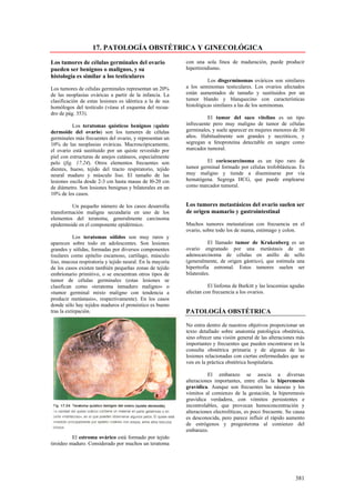 17. PATOLOGÍA OBSTÉTRICA Y GINECOLÓGICA

Los tumores de células germinales del ovario               con una sola línea de maduración, puede producir
pueden ser benignos o malignos, y su                       hipertiroidismo.
histología es similar a los testiculares
                                                                     Los disgerminomas ováricos son similares
Los tumores de células germinales representan un 20%       a los seminomas testiculares. Los ovarios afectados
de las neoplasias ováricas a partir de la infancia. La     están aumentados de tamaño y sustituidos por un
clasificación de estas lesiones es idéntica a la de sus    tumor blando y blanquecino con características
homólogos del testículo (véase el esquema del recua-       histológicas similares a las de los seminomas.
dro de pág. 353).
                                                                     El tumor del saco vitelino es un tipo
          Los teratomas quísticos benignos (quiste         infrecuente pero muy maligno de tumor de células
dermoide del ovario) son los tumores de células            germinales, y suele aparecer en mujeres menores de 30
germinales más frecuentes del ovario, y representan un     años. Habitualmente son grandes y necróticos, y
10% de las neoplasias ováricas. Macroscópicamente,         segregan α fetoproteína detectable en sangre como
el ovario está sustituido por un quiste revestido por      marcador tumoral.
piel con estructuras de anejos cutáneos, especialmente
pelo (fig. 17.24). Otros elementos frecuentes son                   El coricocarcinoma es un tipo raro de
dientes, hueso, tejido del tracto respiratorio, tejido     tumor germinal formado por células trofoblásticas. Es
neural maduro y músculo liso. El tamaño de las             muy maligno y tiende a diseminarse por vía
lesiones oscila desde 2-3 cm hasta masas de l0-20 cm       hematógena. Segrega HCG, que puede emplearse
de diámetro. Son lesiones benignas y bilaterales en un     como marcador tumoral.
10% de los casos.

         Un pequeño número de los casos desarrolla         Los tumores metastásicos del ovario suelen ser
transformación maligna secundaria en uno de los            de origen mamario y gastrointestinal
elementos del teratoma, generalmente carcinoma
epidermoide en el componente epidérmico.                   Muchos tumores metastatizan con frecuencia en el
                                                           ovario, sobre todo los de mama, estómago y colon.
           Los teratomas sólidos son muy raros y
aparecen sobre todo en adolescentes. Son lesiones                     El llamado tumor de Krukenberg es un
grandes y sólidas, formadas por diversos componentes       ovario engranado por una metástasis de un
tisulares como epitelio escamoso, cartílago, músculo       adenocarcinoma de células en anillo de sello
liso, mucosa respiratoria y tejido neural. En la mayoría   (generalmente, de origen gástrico), que estimula una
de los casos existen también pequeñas zonas de tejido      hipertrofia estromal. Estos tumores suelen ser
embrionario primitivo, o se encuentran otros tipos de      bilaterales.
tumor de células germinales (estas lesiones se
clasifican como «teratoma inmaduro maligno» o                        El linfoma de Burkitt y las leucemias agudas
«tumor germinal mixto maligno con tendencia a              afectan con frecuencia a los ovarios.
producir metástasis», respectivamente). En los casos
donde sólo hay tejidos maduros el pronóstico es bueno
tras la extirpación.                                       PATOLOGÍA OBSTÉTRICA

                                                           No entra dentro de nuestros objetivos proporcionar un
                                                           texto detallado sobre anatomía patológica obstétrica,
                                                           sino ofrecer una visión general de las alteraciones más
                                                           importantes y frecuentes que pueden encontrarse en la
                                                           consulta obstétrica primaria y de algunas de las
                                                           lesiones relacionadas con ciertas enfermedades que se
                                                           ven en la práctica obstétrica hospitalaria.

                                                                     El embarazo se asocia a diversas
                                                           alteraciones importantes, entre ellas la hiperemesis
                                                           gravídica. Aunque son frecuentes las náuseas y los
                                                           vómitos al comienzo de la gestación, la hiperemesis
                                                           gravídica verdadera, con vómitos persistentes e
                                                           incontrolables, que provocan hemoconcentración y
                                                           alteraciones electrolíticas, es poco frecuente. Su causa
                                                           es desconocida, pero parece influir el rápido aumento
                                                           de estrógenos y progesterona al comienzo del
                                                           embarazo.
          El estroma ovárico está formado por tejido
tiroideo maduro. Considerado por muchos un teratoma




                                                                                                              381
 