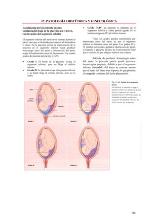 17. PATOLOGÍA OBSTÉTRICA Y GINECOLÓGICA

La placenta previa consiste en una                        •   Grado III/IV. La placenta se implanta en el
implantación baja de la placenta en el útero,                 segmento inferior y cubre parcial (grado III) o
con invasión del segmento inferior                            totalmente (grado IV) el orificio interno.

El segmento inferior del útero no se contrae durante el              Todos los grados pueden manifestarse por
parto, sino que se distiende pasivamente al distenderse   hemorragia antes del parto, ya que el segmento
el útero. En la placenta previa, la implantación de la    inferior se distiende antes del parto. Los grados III y
placenta en el segmento inferior puede producir           IV tienden sobre todo a producir obstrucción del parto,
hemorragia antes del parto u obstrucción del parto,       al impedir la placenta el paso de la presentación fetal
según la localización exacta de la placenta. Hay cuatro   por el orificio, lo que obliga a realizar una cesárea.
grados de placenta previa (fig. 17.29):
                                                                   Además de producir hemorragia antes
•   Grado I. El borde de la placenta invade el            del parto, la placenta previa puede provocar
    segmento inferior, pero no llega al orificio          hemorragias posparto, debido a que el segmento
    interno.                                              inferior distendido del útero se contrae menos
•   Grado II. La placenta ocupa el segmento inferior      que el resto del útero tras el parto, lo que permite
    y su borde llega al orificio interno, pero no lo      el sangrado continuo del lecho placentario.
    cubre.




                                                                                                            386
 
