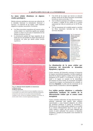 2. ADAPTACIÓN CELULAR A LA ENFERMEDAD

La masa celular disminuye en algunos                         •   Una lesión de los axones que inervan un músculo
estados patológicos                                              produce atrofia de las fibras musculares incriminadas
                                                                 (atrofia por denervación) (fig. 2.15).
Muchos procesos patológicos provocan una reducción de        •   Tras la ablación quirúrgica de la hipófisis, disminuye
la demanda funcional, la estimulación hormonal o                 el numero y tamaño de las células de la corteza
nerviosa o la nutrición de los tejidos; como respuesta           suprarrenal por falta de estimulo por la ACTH (fig.
adaptativa se produce una atrofia o involución.                  2.16).
                                                             •   Tras un traumatismo de la médula espinal, se atrofian
•   Las fibras musculares esqueléticas de la pierna sufren       las fibras musculares inervadas por las raíces
    atrofia celular si se inmoviliza aquélla, por ejemplo        nerviosas afectadas.
    cuando se coloca un yeso para el tratamiento de una
    fractura (atrofia por desuso).
•   La disminución gradual del riego sanguíneo de un
    tejido provoca una pérdida de células funcionales por
    involución, así como por atrofia celular (atrofia
    isquémica).




                                                             La disminución de la masa celular por
                                                             trastornos del desarrollo se denomina
                                                             hipoplasia y agenesia
                                                             Ciertos trastornos del desarrollo ocasionan la formación
                                                             de órganos anormalmente pequeños o la falta completa de
                                                             desarrollo de algunos órganos o tejidos. Estos casos deben
                                                             distinguirse de la atrofia y la involución, en las que el
                                                             tejido o el órgano en cuestión se ha desarrollado
                                                             previamente de forma normal. El crecimiento incompleto
                                                             o parcial de un órgano, con disminución de su tamaño, se
                                                             denomina hipoplasia. La falta total de crecimiento de un
                                                             órgano durante el desarrollo se denomina agenesia.


                                                             Los tejidos pueden adaptarse a estímulos
                                                             ambientales mediante un cambio de la
                                                             diferenciación celular que se conoce como
                                                             metaplasia
                                                             Ciertos estímulos ambientales de larga duración hacen el
                                                             ambiente inadecuado para algunos tipos celulares
                                                             especializados y, como respuesta adaptativa, las células
                                                             que proliferan modifican su patrón de crecimiento y
                                                             diferenciación. Esta células pueden adaptarse a un cambio
                                                             de su entorno diferenciándose hacia un nuevo tipo de
                                                             célula, madura y estable, que está mejor adaptada para
                                                             resistir el estrés ambiental. Este proceso se denomina
                                                             metaplasia y ejemplos de ella pueden verse resumidos en
                                                             la figura 2.17.




                                                                                                                    19
 
