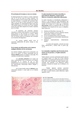 18. MAMA

El carcinoma de la mama es raro en varones                La ginecomastia de la mama masculina es
                                                          generalmente idiopática, aunque puede
El adenocarcinoma de la mama en varones representa        deberse a trastornos endocrinos subyacentes
sólo un 1% de los casos de cáncer mamario. Las
lesiones pueden ser de los mismos tipos observados en     La mama masculina es normalmente rudimentaria e
la mama femenina, a excepción del carcinoma lobu-         inactiva, y está formada por tejido fibroadiposo que
lillar in situ (ya que la mama masculina no contiene      contiene conductos mamarios atróficos. El aumento de
tejido lobulillar). La enfermedad de Paget (véase pág.    tamaño de la mama en el varón, que se denomina
394) también aparece en varones, por lo que cualquier     ginecomastia, puede ser unilateral (70% de los casos)
lesión del pezón debe despertar las mismas sospechas      o bilateral. En la mayoría de los casos es idiopática.
que en la mujer.                                          Otras causas son:

           El pronóstico del carcinoma mamario            •    Síndrome de Klinefelter (véase pág. 93).
masculino es similar al del femenino. La invasión de la   •    Exceso de estrógenos (cirrosis, pubertad, tumores
pared torácica es más frecuente en varones, debido             suprarrenales, estrógenos exógenos).
probablemente al menor tamaño de la mama y, por           •    Exceso de gonadotropinas (tumor testicular).
ello, las lesiones suelen ser localmente más avanzadas
                                                          •    Exceso de prolactina (enfermedades hipotalámicas
en el momento del diagnóstico.
                                                               o hipofisarias).
                                                          •    Fármacos       (espironolactona,   clorpromazina,
          En varones también puede verse el
                                                               digital).
carcinoma epidermoide del pezón, aunque es muy
infrecuente.
                                                                   La mama está engasada, y presenta una masa
                                                          firme, sobreelevada y elástica bajo el pezón (fig.
                                                          18.15).
En la mama son infrecuentes otros tumores
malignos distintos de los carcinomas
                                                          Las anomalías congénitas más frecuentes de la
Los tumores malignos, aparte de los carcinomas, son
raros en la mama. Ya hemos mencionado que los
                                                          mama son los pezones y el tejido mamario
tumores filoides pueden ser malignos (véase pág. 391)     accesorios
y producir invasión local y metástasis.
                                                          Tejido mamario accesorio (polimastia) puede aparecer
          Los sarcomas primarios de la mama son           en cualquier punto a lo largo de la línea mamaria
raros y generalmente sólo se reconocen en la biopsia      embriológica. La localización más frecuente es la axila.
(practicada en la creencia de que se trata                Estas zonas están formadas por tejido mamario espe-
probablemente de un carcinoma). Los principales tipos     cializado, que responde a las influencias tróficas
son angiosarcoma, histiocitoma fibroso maligno y          normales y aumenta de tamaño con el embarazo y la
fibrosarcoma.                                             lactación.

          En la mama pueden aparecer linfomas como                   Pueden     aparecer     pezones   accesorios
enfermedad primaria o como parte de un linfoma            (politelia) a lo largo de la línea mamaria embrionaria.
sistémico.                                                Se sitúan en pared torácica, pared abdominal, región
                                                          inguinal o vulva.




                                                                                                             397
 