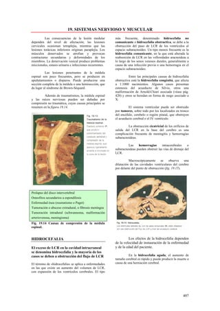 19. SISTEMAS NERVIOSO Y MUSCULAR
          Las consecuencias de la lesión medular           más frecuente, denominado hidrocefalia no
dependen del nivel de afectación; las lesiones             comunicante o hidrocefalia obstructiva, se debe a la
cervicales ocasionan tetraplejía, mientras que las         obstrucción del paso de LCR de los ventrículos al
lesiones torácicas inferiores originan paraplejía. Los     espacio subaracnoideo. Un tipo menos frecuente es la
músculos denervados se atrofian y provocan                 hidrocefalia comunicante, en la que está alterada la
contracturas secundarias y deformidades de los             reabsorción de LCR en las vellosidades aracnoideas a
miembros. La denervación vesical produce problemas         lo largo de los senos venosos durales, generalmente a
miccionales, estasis urinaria e infecciones recurrentes.   causa de una infección previa o una hemorragia en el
                                                           espacio subaracnoideo.
          Las lesiones penetrantes de la médula
espinal son poco frecuentes, pero se producen en                     Entre las principales causas de hidrocefalia
apuñalamientos o disparos. Puede producirse una            obstructiva está la hidrocefalia congénita, que afecta
sección completa de la médula o una hemisección, que       a 1:1000 nacimientos. Algunos casos presentan
da lugar al síndrome de Brown-Séquard.                     estenosis del acueducto de Silvio, otros una
                                                           malformación de Arnold-Chiari asociada (véase pág.
         Además de traumatismos, la médula espinal         420) y otros se heredan en forma de rasgo asociado a
y las raíces nerviosas pueden ser dañadas por              X.
compresión no traumática, cuyas causas principales se
resumen en la figura 19.14.                                          El sistema ventricular puede ser obstruido
                                                           por tumores, sobre todo por los localizados en tronco
                                                           del encéfalo, cerebelo o región pineal, que obstruyen
                                                           el acueducto cerebral o el IV ventrículo.

                                                                    La obstrucción cicatricial de los orificios de
                                                           salida del LCR en la base del cerebro es una
                                                           complicación frecuente de meningitis y hemorragias
                                                           subaracnoideas.

                                                                    Las    hemorragias       intracerebrales   o
                                                           subaracnoideas pueden obstruir las vías de drenaje del
                                                           LCR.

                                                                     Macroscópicamente       se    observa    una
                                                           dilatación de las cavidades ventriculares del cerebro
                                                           por delante del punto de obstrucción (fig. 19.15).




Prolapso del disco intervertebral
Osteofitos secundarios a espondilosis
Enfermedad ósea (reumatismo o Paget)
Tumoración o absceso extradural, o fibrosis meníngea
Tumoración intradural (schwannoma, malformación
arteriovenosa, meningioma)
Fig. 19.14 Causas de compresión de la médula
espinal.


HIDROCEFALIA                                                        Los efectos de la hidrocefalia dependen
                                                           de la velocidad de instauración de la enfermedad
El exceso de LCR en la cavidad intracraneal                y de la edad del paciente.
se denomina hidrocefalia y la mayoría de los
casos se deben a obstrucción del flujo de LCR                        En la hidrocefalia aguda, el aumento de
                                                           tamaño cerebral es rápido y puede producir la muerte a
El término de «hidrocefalia» se aplica a enfermedades      causa de una herniación cerebral.
en las que existe un aumento del volumen de LCR,
con expansión de los ventrículos cerebrales. El tipo




                                                                                                             407
 