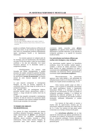 19. SISTEMAS NERVIOSO Y MUSCULAR




pueden ser múltiples. Puede producirse infiltración del   crecimiento rápido, conocidos como gliomas
cráneo por tumor, lo que ocasiona un engrosamiento        anaplásicos. Los gliomas tienen tendencia a infiltrar
óseo local Los meningiomas producen habitualmente         difusamente el encéfalo adyacente, lo que dificulta su
signos neurológicos focales y de hipertensión             extirpación quirúrgica y va seguido de frecuentes
intracraneal.                                             recidivas locales.

          Los tumores aparecen en cualquier parte de      Los astrocitomas son lesiones difusas que
las meninges, pero las localizaciones más frecuentes      oscilan entre benignas y muy malignas
son junto a la hoz del cerebro y sobre las convexidades
cerebrales y las alas del esfenoides. Con menor           Los astrocitomas pueden aparecer en hemisferios
frecuencia aparecen en la duramadre espinal y             cerebrales, tronco del encéfalo, médula espinal o
comprimen la médula.                                      cerebelo, y derivan de células astrocíticas. Varían
                                                          desde tumores sin signos histológicos de atipia y
           Histológicamente, los tumores están            crecimiento lento (astrocitoma) hasta lesiones de gran
formados por células meningoteliales, y pueden            celularidad, con numerosas mitosis, pleomorfismo y
presentar una amplia variedad de patrones histológi-      crecimiento rápido (astrocitoma anaplásico).
cos. Un signo típico es la presencia de pequeños focos
de calcificación (cuerpos de psammoma). La historia                Macroscópicamente,         los    astrocitomas
natural de estos tumores depende del patrón               aparecen como zonas pálidas y mal delimitadas de
histológico.                                              reblandecimiento tisular en el sistema nervioso, que se
                                                          funden con el tejido normal circundante (fig. 19.32).
La gran mayoría corresponde a meningiomas
benignos. Se trata de lesiones expansivas de                        Estos tumores pueden surgir en niños o
crecimiento lento, con bajo riesgo de recidivar tras su   adultos, y por lo general se manifiestan clínicamente
extirpación quirúrgica.                                   con signos neurológicos focales o hipertensión
Una pequeña parte son meningiomas atípicos,               intracraneal. Debido a la naturaleza difusa de la
presentan muchas mitosis, pleomorfismo celular y          mayoría de los astrocitomas, no suele ser posible su
necrosis, y riesgo elevado de recidiva local tras la      extirpación quirúrgica completa, y es habitual un
cirugía.                                                  tratamiento de reducción quirúrgica de la masa y
Un grupo muy pequeño corresponde a meningiomas            radioterapia. No metastatizan, pero pueden extenderse
malignos. Se trata de tumores de crecimiento rápido       localmente, infiltrando difusamente el cerebro
que se comportan como tumores malignos localmente         circundante.
invasivos que recuerdan a los sarcomas.
                                                                    Los tumores de bajo grado se asocian a
                                                          muchos años de supervivencia, mientras que los
TUMORES DE ORIGEN                                         astrocitomas anaplásicos presentan una supervivencia
NEUROEPITELIAL                                            de 4 a 5 años. Los tumores de bajo grado suelen
                                                          evolucionar con el tiempo a formas de alto grado.
Los tumores de origen neuroepitelial son tumores
encefálicos primarios frecuentes, agrupados bajo la                 Los astrocitomas pilocíticos son un tipo
amplia denominación de gliomas. Los principales           especial de astrocitoma que aparece generalmente en
tipos derivan de astrocitos, oligodendrocitos,            el cerebelo en la infancia. Su pronóstico es excelente
epéndimo, plexos coroideos, neuronas y células            tras su extirpación quirúrgica. Forman típicamente
embrionarias. Varían desde lesiones benignas, de          lesiones quísticas con un nódulo tumoral sólido en la
crecimiento lento, hasta tumores malignos de              pared del quiste.



                                                                                                            424
 