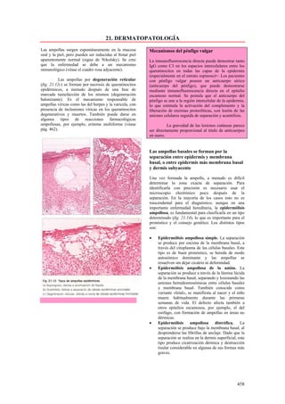 21. DERMATOPATOLOGÍA
Las ampollas surgen espontáneamente en la mucosa           Mecanismos del pénfigo vulgar
oral y la piel, pero pueden ser inducidas al frotar piel
aparentemente normal (signo de Nikolsky). Se cree          La inmunofluorescencia directa puede demostrar tanto
que la enfermedad se debe a un mecanismo                   IgG como C3 en los espacios intercelulares entre los
inmunológico (véase el cuadro rosa adyacente).             queratinocitos en todas las capas de la epidermis
                                                           (especialmente en el estrato espinoso)=. Los pacientes
           Las ampollas por degeneración reticular         con pénfigo vulgar poseen un anticuerpo sérico
(fig. 21.12c) se forman por necrosis de queratinocitos     (anticuerpo del pénfigo), que puede demostrarse
epidérmicos, a menudo después de una fase de               mediante inmunofluorescencia directa en el epitelio
marcada tumefacción de los mismos (degeneración            escamoso normal. Se postula que el anticuerpo del
balonizante). Es el mecanismo responsable de               pénfigo se une a la región intercelular de la epidermis,
ampollas víricas como las del herpes y la varicela, con    lo que estimula la activación del complemento y la
presencia de inclusiones víricas en los queratinocitos     liberación de enzimas proteolíticas, con lesión de las
degenerativos y muertos. También puede darse en            uniones celulares seguida de separación y acantólisis.
algunos tipos de reacciones farmacológicas
ampollosas, por ejemplo, eritema multiforme (véase                   La gravedad de las lesiones cutáneas parece
pág. 462).                                                 ser directamente proporcional al título de anticuerpos
                                                           en suero.


                                                           Las ampollas basales se forman por la
                                                           separación entre epidermis y membrana
                                                           basal, o entre epidermis más membrana basal
                                                           y dermis subyacente

                                                           Una vez formada la ampolla, a menudo es difícil
                                                           determinar la zona exacta de separación. Para
                                                           identificarla con precisión es necesario usar el
                                                           microscopio electrónico poco después de la
                                                           separación. En la mayoría de los casos esto no es
                                                           trascendental para el diagnóstico, aunque en una
                                                           importante enfermedad hereditaria, la epidermólisis
                                                           ampollosa, es fundamental para clasificarla en un tipo
                                                           determinado (fig. 21.14), lo que es importante para el
                                                           pronóstico y el consejo genético. Los distintos tipos
                                                           son:

                                                           •    Epidermólisis ampollosa simple. La separación
                                                                se produce por encima de la membrana basal, a
                                                                través del citoplasma de las células basales. Este
                                                                tipo es de buen pronóstico, se hereda de modo
                                                                autosómico dominante y las ampollas se
                                                                resuelven sin dejar cicatriz ni deformidad.
                                                           •    Epidermólisis ampollosa de la unión. La
                                                                separación se produce a través de la lámina lúcida
                                                                de la membrana basal, separando y lesionando las
                                                                uniones hemidesmosómicas entre células basales
                                                                y membrana basal. También conocida como
                                                                variante «letal», se manifiesta al nacer y el niño
                                                                muere habitualmente durante las primeras
                                                                semanas de vida. El defecto afecta también a
                                                                otros epitelios escamosos, por ejemplo, el del
                                                                esófago, con formación de ampollas en áreas no
                                                                dérmicas.
                                                           •    Epidermólisis ampollosa distrófica. La
                                                                separación se produce bajo la membrana basal, al
                                                                desprenderse las fibrillas de anclaje. Dado que la
                                                                separación se realiza en la dermis superficial, este
                                                                tipo produce cicatrización dérmica y destrucción
                                                                tisular considerable en algunas de sus formas más
                                                                graves.




                                                                                                               458
 