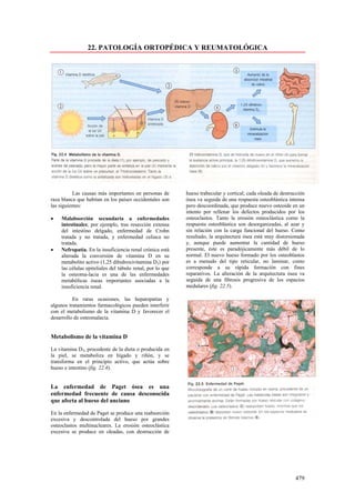 22. PATOLOGÍA ORTOPÉDICA Y REUMATOLÓGICA




          Las causas más importantes en personas de        hueso trabecular y cortical; cada oleada de destrucción
raza blanca que habitan en los países occidentales son     ósea va seguida de una respuesta osteoblástica intensa
las siguientes:                                            pero descoordinada, que produce nuevo osteoide en un
                                                           intento por rellenar los defectos producidos por los
•   Malabsorción secundaria a enfermedades                 osteoclastos. Tanto la erosión osteoclástica como la
    intestinales; por ejemplo, tras resección extensa      respuesta osteoblástica son desorganizadas, al azar y
    del intestino delgado, enfermedad de Crohn             sin relación con la carga funcional del hueso. Como
    tratada y no tratada, y enfermedad celiaca no          resultado, la arquitectura ósea está muy distorsionada
    tratada.                                               y, aunque puede aumentar la cantidad de hueso
•   Nefropatía. En la insuficiencia renal crónica está     presente, éste es paradójicamente más débil de lo
    alterada la conversión de vitamina D en su             normal. El nuevo hueso formado por los osteoblastos
    metabolito activo (1,25 dihidroxivitamina D3) por      es a menudo del tipo reticular, no laminar, como
    las células epiteliales del túbulo renal, por lo que   corresponde a su rápida formación con fines
    la osteoma-lacia es una de las enfermedades            reparativos. La alteración de la arquitectura ósea va
    metabólicas óseas importantes asociadas a la           seguida de una fibrosis progresiva de los espacios
    insuficiencia renal.                                   medulares (fig. 22.5).

          En raras ocasiones, las hepatopatías y
algunos tratamientos farmacológicos pueden interferir
con el metabolismo de la vitamina D y favorecer el
desarrollo de osteomalacia.


Metabolismo de la vitamina D

La vitamina D3, procedente de la dieta o producida en
la piel, se metaboliza en hígado y riñón, y se
transforma en el principio activo, que actúa sobre
hueso e intestino (fig. 22.4).


La enfermedad de Paget ósea es una
enfermedad frecuente de causa desconocida
que afecta al hueso del anciano

En la enfermedad de Paget se produce una reabsorción
excesiva y descontrolada del hueso por grandes
osteoclastos multinucleares. La erosión osteoclástica
excesiva se produce en oleadas, con destrucción de




                                                                                                             479
 