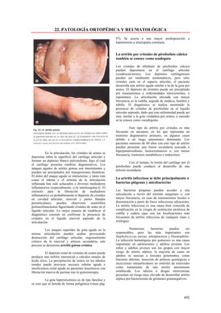 22. PATOLOGÍA ORTOPÉDICA Y REUMATOLÓGICA
                                                            97). Se asocia a una mayor predisposición a
                                                            hipertensión y arteriopatía coronaría.


                                                            La artritis por cristales de pirofosfato cálcico
                                                            también se conoce como seudogota

                                                            Los cristales de dihidrato de pirofosfato cálcico
                                                            pueden depositarse en el cartílago articular
                                                            (condrocalcinosis). Los depósitos cartilaginosos
                                                            pueden ser totalmente asintomáticos, pero silos
                                                            cristales caen en el espacio articular, el paciente
                                                            desarrolla una artritis aguda similar a la de la gota por
                                                            uratos. El depósito de cristales puede ser precipitado
                                                            por traumatismos y enfermedades intercurrentes, o
                                                            espontáneo. La articulación afectada con mayor
                                                            frecuencia es la rodilla, seguida de muñeca, hombro y
                                                            tobillo. El diagnóstico se realiza mostrando la
                                                            presencia de cristales de pirofosfato en el liquido
                                                            articular aspirado; dado que esta enfermedad puede ser
                                                            muy similar a la gota verdadera por uratos, a menudo
                                                            se la conoce como «seudogota».

                                                                      Este tipo de artritis por cristales es más
                                                            frecuente en ancianos, en los que representa un
                                                            trastorno degenerativo primario, en algunos casos
                                                            debido a un rasgo autosómico dominante. Los
                                                            pacientes menores de 60 años con este tipo de artritis
                                                            pueden presentar una forma secundaria asociada a
                                                            hiperparatiroidismo, hemocromatosis o, con menor
           En la articulación, los cristales de uratos se
                                                            frecuencia, trastornos metabólicos o endocrinos.
depositan sobre la superficie del cartílago articular y
forman un depósito blanco pulverulento, bajo el cual
                                                                       Con el tiempo, la lesión del cartílago por el
el cartílago presenta cambios degenerativos. Los
                                                            pirofosfato puede conducir al desarrollo de una
ataques agudos de artritis gotosa son intermitentes y
                                                            artrosis secundaria.
pueden ser precipitados por transgresiones dietéticas.
El dolor del ataque agudo es intensísimo, y tanto éste
como el edema y el eritema de la articulación               La artritis infecciosa se debe principalmente a
inflamada han sido achacados a diversos mediadores          bacterias piógenas y micobacterias
inflamatorios (especialmente, a la interleuquina-l). El
estímulo para la liberación de mediadores                   Las bacterias piógenas pueden acceder a una
inflamatorios es probablemente el depósito de cristales     articulación a través del torrente sanguíneo o, con
en cavidad articular, sinovial y partes blandas             mayor frecuencia, en caso de traumatismos locales o
periarticulares;    pueden     observarse     neutrófilos   diseminación a partir de focos infecciosos adyacentes.
polimorfonucleares fagocitando cristales de urato en el     La artritis infecciosa es una causa bien conocida de
liquido articular. La mejor manera de establecer el         complicación en la cirugía de sustitución protésica de
diagnóstico consiste en confirmar la presencia de           rodilla y cadera (que son las localizaciones más
cristales en el liquido sinovial aspirado de la             frecuentes de artritis infecciosa de cualquier clase y
articulación.                                               etiología).

          Los ataques repetidos de gota aguda en la                   Numerosas        bacterias    pueden      ser
misma articulación pueden acabar provocando                 responsables, pero las más importantes son
destrucción del cartílago articular, engrosamiento          Staphylococcus aureus, estreptococos y Haemophilus.
crónico de la sinovial y artrosis secundaria; este          La infección hematógena por gonococo es una causa
proceso se denomina artritis gotosa crónica.                importante en adolescentes y adultos jóvenes. Los
                                                            niños y adultos jóvenes son los grupos con mayor
          El depósito renal de cristales de uratos puede    riesgo de artritis séptica; la mayoría de casos en
producir una nefritis intersticial y cálculos renales de    adultos se asocian a lesiones penetrantes, como
ácido úrico. La precipitación de uratos en los túbulos      fracturas abiertas, inserción de prótesis quirúrgicas e
renales puede provocar necrosis tubular aguda e             inyecciones intraarticulares no estériles de esteroides
insuficiencia renal aguda en pacientes leucémicos con       como tratamiento de una artritis autoinmune
liberación masiva de purinas tras la quimioterapia.         establecida. Los adictos a drogas intravenosas
                                                            presentan un riesgo muy elevado de desarrollar artritis
          La gota hiperuricémica es de tipo familiar y      séptica por bacteriemias de gérmenes gramnegativos.
se cree que se hereda de forma poligénica (véase pág.



                                                                                                                492
 