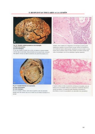 5. RESPUESTAS TISULARES A LA LESIÓN




                                      64
 