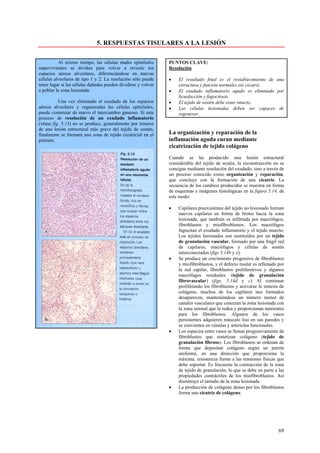 5. RESPUESTAS TISULARES A LA LESIÓN

          Al mismo tiempo, las células madre epiteliales       PUNTOS CLAVE:
supervivientes se dividen para volver a revestir los           Resolución
espacios aéreos alveolares, diferenciándose en nuevas
células alveolares de tipo 1 y 2. La resolución sólo puede     •   El resultado final es el restablecimiento de una
tener lugar si las células dañadas pueden dividirse y volver       estructura y función normales sin cicatriz.
a poblar la zona lesionada.                                    •   El exudado inflamatorio agudo es eliminado por
                                                                   licuefacción y fagocitosis.
          Una vez eliminado el exudado de los espacios         •   El tejido de sostén debe estar intacto.
aéreos alveolares y regeneradas las células epiteliales,       •   Las células lesionadas deben ser capaces de
puede comenzar de nuevo el intercambio gaseoso. Si este            regenerar.
proceso de resolución de un exudado inflamatorio
(véase fig. 5.13) no se produce, generalmente por tratarse
de una lesión estructural más grave del tejido de sostén,
finalmente se formará una zona de tejido cicatricial en el     La organización y reparación de la
pulmón.                                                        inflamación aguda curan mediante
                                                               cicatrización de tejido colágeno
                                                               Cuando se ha producido una lesión estructural
                                                               considerable del tejido de sostén, la reconstrucción no se
                                                               consigue mediante resolución del exudado, sino a través de
                                                               un proceso conocido como organización y reparación,
                                                               que concluye con la formación de una cicatriz. La
                                                               secuencia de los cambios producidos se muestra en forma
                                                               de esquemas e imágenes histológicas en la figura 5.14, de
                                                               este modo:

                                                               •   Capilares preexistentes del tejido no lesionado forman
                                                                   nuevos capilares en forma de brotes hacia la zona
                                                                   lesionada, que también es infiltrada por macrófagos,
                                                                   fibroblastos y miofibroblastos. Los macrófagos
                                                                   fagocitan el exudado inflamatorio y el tejido muerto,
                                                                   Los tejidos lesionados son sustituidos por un tejido
                                                                   de granulación vascular, formado por una frágil red
                                                                   de capilares, macrófagos y células de sostén
                                                                   interconectados (figs 5.14b y c).
                                                               •   Se produce un crecimiento progresivo de fibroblastos
                                                                   y miofibroblastos, y el defecto tisular es rellenado por
                                                                   la red capilar, fibroblastos proliferativos y algunos
                                                                   macrófagos residuales (tejido de granulación
                                                                   fibrovascular) (figs. 5.14d y c) Al continuar
                                                                   proliferando los fibroblastos y activarse la síntesis de
                                                                   colágeno, muchos de los capilares neo formados
                                                                   desaparecen, manteniéndose un número menor de
                                                                   canales vasculares que conectan la zona lesionada con
                                                                   la zona normal que la rodea y proporcionan nutrientes
                                                                   para los fibroblastos. Algunos de los vasos
                                                                   persistentes adquieren músculo liso en sus paredes y
                                                                   se convierten en vénulas y arteriolas funcionales.
                                                               •   Los espacios entre vasos se llenan progresivamente de
                                                                   fibroblastos que sintetizan colágeno (tejido de
                                                                   granulación fibroso). Los fibroblastos se ordenan de
                                                                   forma que depositan colágeno según un patrón
                                                                   uniforme, en una dirección que proporciona la
                                                                   máxima. resistencia frente a las tensiones físicas que
                                                                   debe soportar. Es frecuente la contracción de la zona
                                                                   de tejido de granulación, lo que se debe en parte a las
                                                                   propiedades contráctiles de los miofibroblastos. Así
                                                                   disminuye el tamaño de la zona lesionada.
                                                               •   La producción de colágeno denso por los fibroblastos
                                                                   forma una cicatriz de colágeno.




                                                                                                                        69
 
